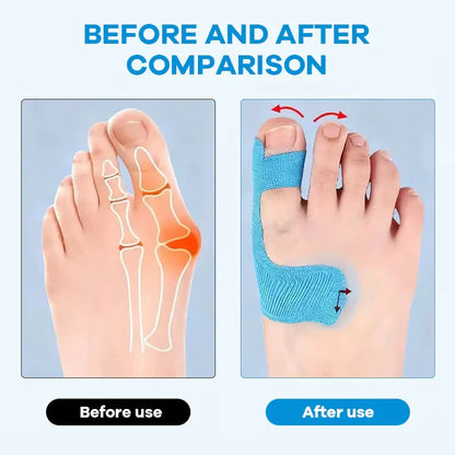 🔥LAST DAY 50% OFF - 👣Pre-cut Hallux Valgus Corrector Kinesiology Tape -Bestseller